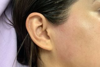 Side face wax Side face wax